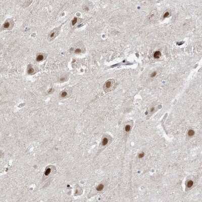 Immunohistochemistry-Paraffin: WAC Antibody [NBP1-88581] - Staining of human hippocampus shows strong nuclear positivity in neuronal cells.