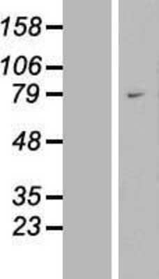 Western Blot: WAC Overexpression Lysate (Adult Normal) [NBL1-17771] Left-Empty vector transfected control cell lysate (HEK293 cell lysate); Right -Over-expression Lysate for WAC.