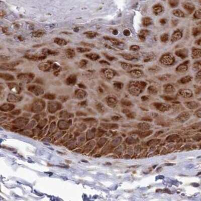 Immunohistochemistry-Paraffin: WAPL Antibody [NBP1-92578] - Staining of human skin.