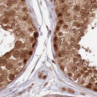 Immunohistochemistry-Paraffin: WAPL Antibody [NBP1-92579] - Staining of human testis.