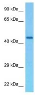 Western Blot: WARP/VWA1 Antibody [NBP3-10148] - Western blot analysis of WARP/VWA1 in Rat Brain lysates. Antibody dilution at 1ug/ml