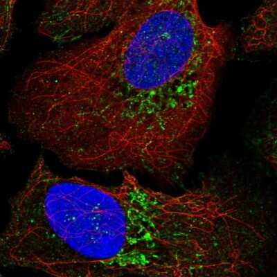 Immunocytochemistry/Immunofluorescence: WARS2 Antibody [NBP2-57679] - Staining of human cell line U-2 OS shows localization to mitochondria.