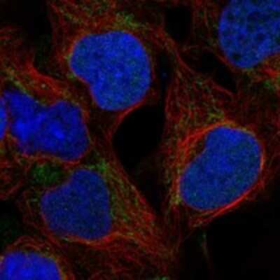 Immunocytochemistry/Immunofluorescence: WARS2 Antibody [NBP3-17325] - Staining of human cell line HEK 293 shows localization to nucleoplasm & mitochondria.