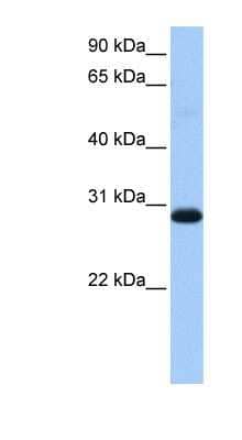 Western Blot: WARS2 Antibody [NBP1-54653] - Human Muscle lysate, concentration 0.2-1 ug/ml.