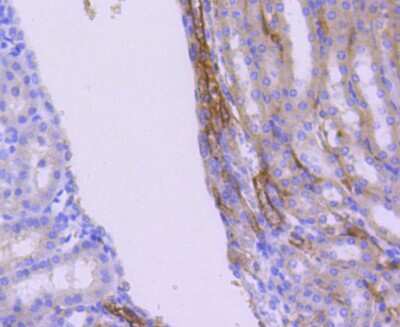 Immunohistochemistry-Paraffin: WASF2 Antibody (SC66-05) [NBP2-67613] - Analysis of paraffin-embedded mouse kidney tissue using anti-WASF2 antibody. Counter stained with hematoxylin.