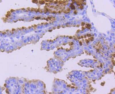 Immunohistochemistry-Paraffin: WASF2 Antibody (SC66-05) [NBP2-67613] - Analysis of paraffin-embedded mouse placenta tissue using anti-WASF2 antibody. Counter stained with hematoxylin.