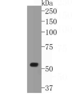 Western Blot: WASF2 Antibody (SC66-05) [NBP2-67613] - Analysis of WASF2 on human placenta tissue lysates. Proteins were transferred to a PVDF membrane and blocked with 5% BSA in PBS for 1 hour at room temperature. The primary antibody (1/500) was used in 5% BSA at room temperature for 2 hours. Goat Anti-Rabbit IgG - HRP Secondary Antibody at 1:5,000 dilution was used for 1 hour at room temperature.