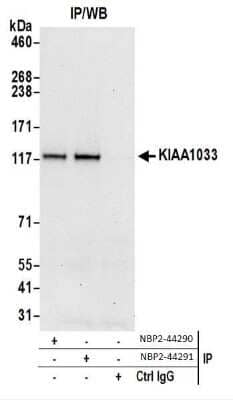 Immunoprecipitation: WASHC4 Antibody [NBP2-44290] - Western Blot of Immunoprecipitates. Samples: Whole cell lysate (0.5 or 1.0 mg per IP reaction; 20% of IP loaded) from HeLa cells prepared using NETN lysis buffer.NBP2-44290 was used for IP at 6 ug per reaction. KIAA1033 was also immunoprecipitated by NBP2-44291.