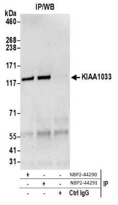 Western Blot WASHC4 Antibody