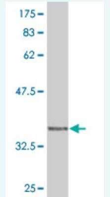 Western Blot: WASP Antibody (3H5) [H00007454-M05] - Detection against Immunogen (38.28 KDa) .