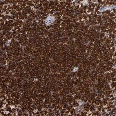 Immunohistochemistry-Paraffin: WASP Antibody [NBP1-87827] - Staining of human spleen shows strong cytoplasmic positivity in cells in red pulp and cells in white pulp.