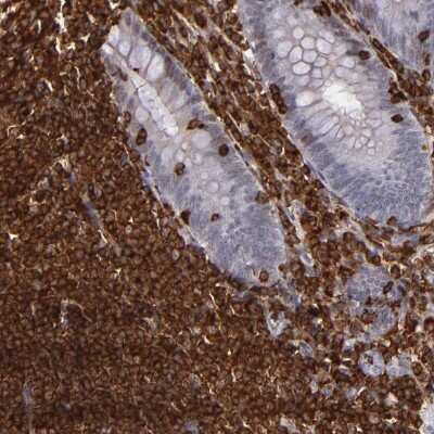 Immunohistochemistry-Paraffin: WASP Antibody [NBP1-87827] - Staining of human appendix shows high expression.