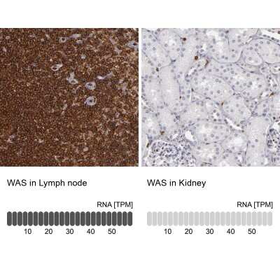 Immunohistochemistry-Paraffin: WASP Antibody [NBP1-87827] - Analysis in human lymph node and kidney tissues using NBP1-87827 antibody. Corresponding WASP RNA-seq data are presented for the same tissues.