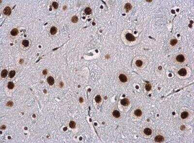 Immunohistochemistry-Paraffin: WBP11 Antibody [NBP2-20886] - Paraffin-embedded rat brain. WBP11 antibodydiluted at 1:500.