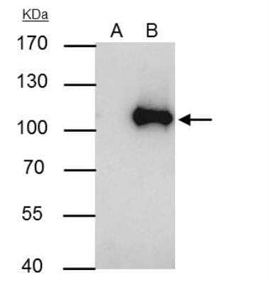 Immunoprecipitation: WBP11 Antibody [NBP2-20886] - Jurkat whole cell extract A. Control with 4 ug of preimmune Rabbit IgG B. Immunoprecipitation of WBP11 protein by 4 ug WBP11 antibody 7.5 % SDS-PAGE The immunoprecipitated WBP11 protein was detected by WBP11 antibody diluted at 1:1000. [EasyBlot anti-rabbit IgG was used as a secondary reagent]