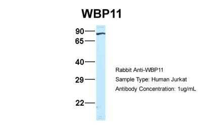 Western Blot: WBP11 Antibody [NBP1-54648] - Jurkat, Antibody Dilution: 1.0 ug/ml WBP11 is strongly supported by BioGPS gene expression data to be expressed in Jurkat.