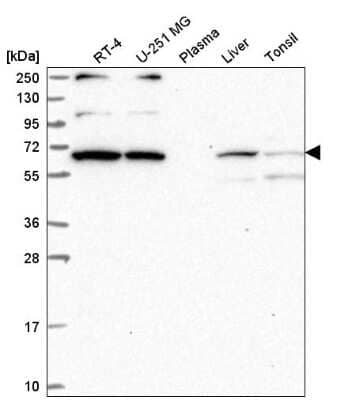 Western Blot: WBP11 Antibody [NBP2-58142] - Western blot analysis in human cell line RT-4, human cell line U-251 MG, human plasma, human liver tissue and human tonsil tissue.
