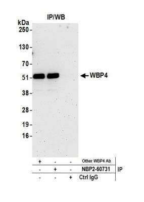 Immunoprecipitation: WBP4 Antibody [NBP2-60731] - Detection of human WBP4 by western blot of immunoprecipitates. Samples: Whole cell lysate (0.5 or 1.0 mg per IP reaction; 20% of IP loaded) from HeLa cells prepared using NETN lysis buffer. Antibodies: Affinity purified rabbit anti-WBP4 antibody NBP2-60731 used for IP at 8 ul per reaction. WBP4 was also immunoprecipitated by another rabbit anti-WBP4 antibody. For blotting immunoprecipitated WBP4, NBP2-60731 was used at 1:400. Detection: Chemiluminescence with an exposure time of 3 minutes.