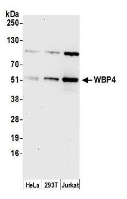 Western Blot: WBP4 Antibody [NBP2-60731] - Detection of human WBP4 by western blot. Samples: Whole cell lysate (15 ug) from HeLa, 293T, and Jurkat cells prepared using NETN lysis buffer. Antibody: Affinity purified rabbit anti-WBP4 antibody NBP2-60731 used for WB at 1:1000. Detection: Chemiluminescence with an exposure time of 30 seconds.