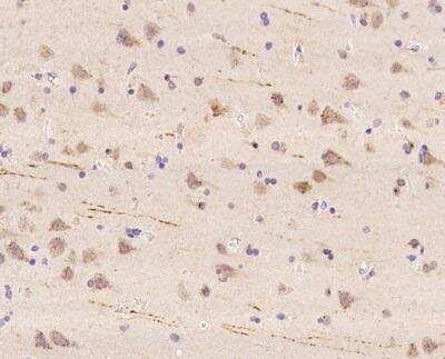 Immunohistochemistry-Paraffin: WBSCR17 Antibody [NBP3-12659] - Staining of human WBSCR17 in human brain with rabbit polyclonal antibody at 1:500 dilution.