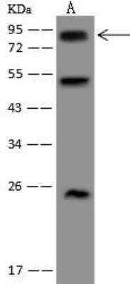 Western Blot: WBSCR17 Antibody [NBP3-12659] - Lane A: Mouse stomach tissue lysate Whole Cell LysateLane B: U-251MG Whole Cell LysateLysates/proteins at 30 ug per lane.SecondaryGoat Anti-Rabbit IgG (H+L)/HRP at 1/10000 dilution.Developed using the ECL technique.Performed under reducing conditions.Predicted band size:67 kDaObserved band size:80 kDa(We are unsure as to the identity of these extra bands.)