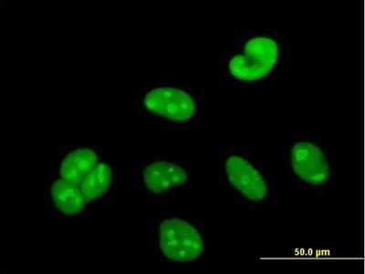 Immunocytochemistry/Immunofluorescence: WBSCR22 Antibody [H00114049-B01P] - Analysis of purified antibody to WBSCR22 on HeLa cell. (antibody concentration 10 ug/ml)