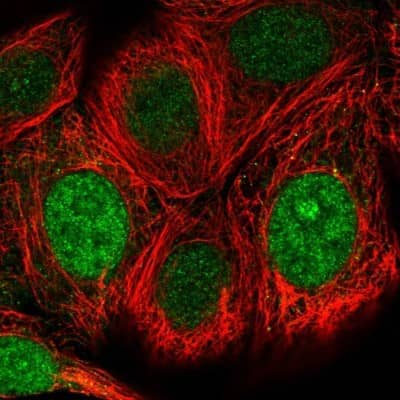 Immunocytochemistry/Immunofluorescence: WBSCR22 Antibody [NBP2-13520] - Immunofluorescent staining of human cell line MCF7 shows localization to nucleus & nucleoli.