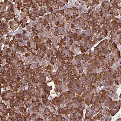 Immunohistochemistry-Paraffin: WBSCR22 Antibody [NBP2-13520] - Staining of human pancreas shows strong cytoplasmic positivity in exocrine glandular cells.