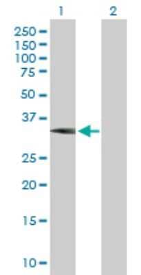 Western Blot: WBSCR22 Antibody [H00114049-B01P] - Analysis of WBSCR22 expression in transfected 293T cell line by WBSCR22 polyclonal antibody.  Lane 1: WBSCR22 transfected lysate(30.91 KDa). Lane 2: Non-transfected lysate.