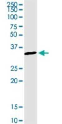 Western Blot: WBSCR22 Antibody [H00114049-D01P] - Analysis of WBSCR22 expression in rat brain.