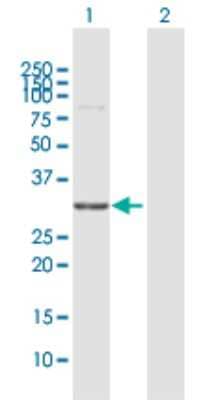 Western Blot: WBSCR22 Antibody [H00114049-D01P] - Analysis of WBSCR22 expression in transfected 293T cell line by WBSCR22 polyclonal antibody.Lane 1: WBSCR22 transfected lysate(31.90 KDa).Lane 2: Non-transfected lysate.