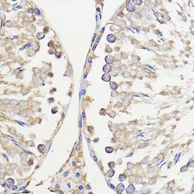Immunohistochemistry-Paraffin: WBSCR27 Antibody [NBP2-93973] - Immunohistochemistry of paraffin-embedded Rat testis using WBSCR27 Rabbit pAb (NBP2-93973) at dilution of 1:50 (40x lens). Perform microwave antigen retrieval with 10 mM PBS buffer pH 7.2 before commencing with IHC staining protocol.