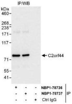 Immunoprecipitation: WDCP Antibody [NBP1-78736] - Whole cell lysate (1 mg for IP, 20% of IP loaded) from 293T cells.  Affinity purified rabbit anti-C2orf44 antibody used for IP at 6 mcg/mg lysate.  C2orf44 was also immunoprecipitated by rabbit anti-C2orf44 antibody NBP1-78737, which recognizes a downstream epitope.