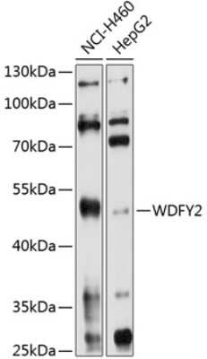 Western Blot: WDFY2 Antibody [NBP2-94201] - Analysis of extracts of various cell lines, using WDFY2 at 1:1000 dilution. Secondary antibody: HRP Goat Anti-Rabbit IgG (H+L) at 1:10000 dilution. Lysates/proteins: 25ug per lane. Blocking buffer: 3% nonfat dry milk in TBST. Detection: ECL Basic Kit . Exposure time: 30s.