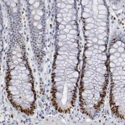 Immunohistochemistry-Paraffin: WDHD1 Antibody [NBP1-89091] - Staining of human rectum shows strong nuclear positivity in glandular cells.