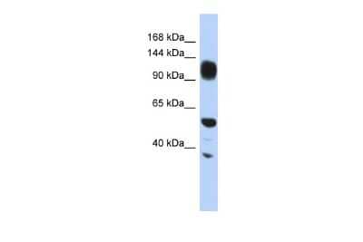 Western Blot: WDHD1 Antibody [NBP2-86064] - WB Suggested Anti-WDHD1 Antibody Titration: 0.2-1 ug/ml. ELISA Titer: 1:12500. Positive Control: HepG2 cell lysate