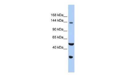 Western Blot: WDHD1 Antibody [NBP2-86065] - WB Suggested Anti-WDHD1 Antibody Titration: 0.2-1 ug/ml. ELISA Titer: 1:62500. Positive Control: Hela cell lysate