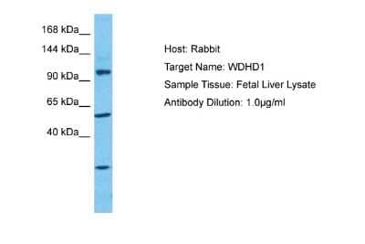 Western Blot: WDHD1 Antibody [NBP2-86067] - Host: Rabbit. Target Name: WDHD1. Sample Type: Fetal Liver. Antibody Dilution: 1.0ug/ml