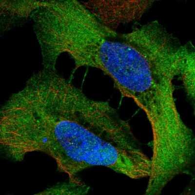 Immunocytochemistry/Immunofluorescence: WDR1 Antibody [NBP2-68898] - Staining of human cell line U-2 OS shows localization to plasma membrane & cell junctions. Antibody staining is shown in green.