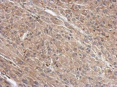 Immunohistochemistry-Paraffin: WDR1 Antibody [NBP2-20887] - U87 xenograft, using WDR1 antibody at 1:500 dilution.  Antigen Retrieval: Trilogy™ (EDTA based, pH 8.0) buffer, 15min