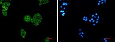 Immunocytochemistry/Immunofluorescence: WDR1 Antibody (S01-6D6) [NBP3-19802] - Immunocytochemistry of WDR1 (green) in hela using NBP3-19802 at dilution 1/5, and DAPI (blue)