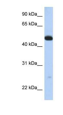 Western Blot: WDR1 Antibody [NBP1-54754] - Human Muscle lysate, concentration 0.2-1 ug/ml.