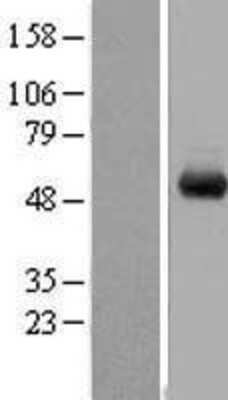 Western Blot: WDR1 Overexpression Lysate (Adult Normal) [NBL1-17791] Left-Empty vector transfected control cell lysate (HEK293 cell lysate); Right -Over-expression Lysate for WDR1.