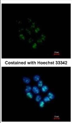 Immunocytochemistry/ Immunofluorescence WDR12 Antibody - BSA Free