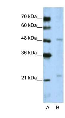 Western Blot: WDR12 Antibody [NBP1-53111] - Jurkat cell lysate, concentration 5.0ug/ml.