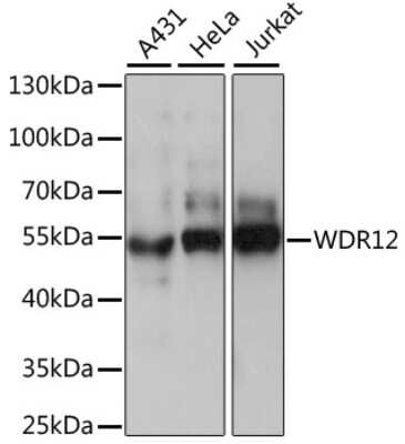 Western Blot: WDR12 Antibody [NBP2-94831] - Analysis of extracts of various cell lines, using WDR12 at 1:1000 dilution. Secondary antibody: HRP Goat Anti-Rabbit IgG (H+L) at 1:10000 dilution. Lysates/proteins: 25ug per lane. Blocking buffer: 3% nonfat dry milk in TBST. Detection: ECL Basic Kit . Exposure time: 30s.