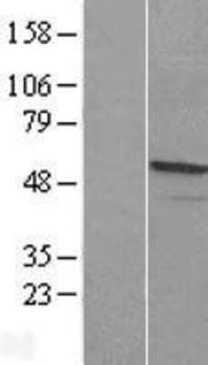 Western Blot: WDR12 Overexpression Lysate (Adult Normal) [NBL1-17792] Left-Empty vector transfected control cell lysate (HEK293 cell lysate); Right -Over-expression Lysate for WDR12.