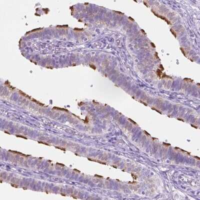 Immunohistochemistry-Paraffin: WDR16 Antibody [NBP1-81947] - Staining of human Fallopian tube shows strong positivity in cilia in glandular cells.