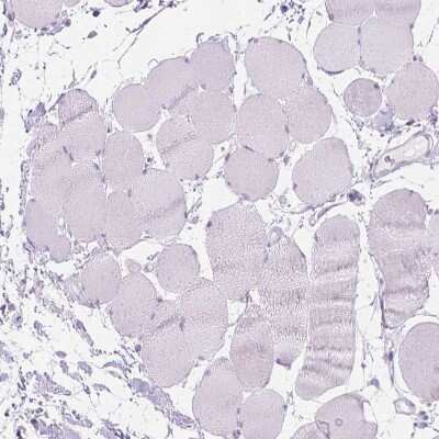 <b>Orthogonal Strategies Validation. </b>Immunohistochemistry-Paraffin: WDR16 Antibody [NBP1-81947] - Staining of human Skeletal muscle shows no positivity in myocytes as expected.