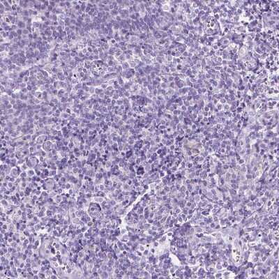 Immunohistochemistry-Paraffin: WDR16 Antibody [NBP1-81947] - Staining of human Tonsil shows no positivity in non-germinal center cells as expected.